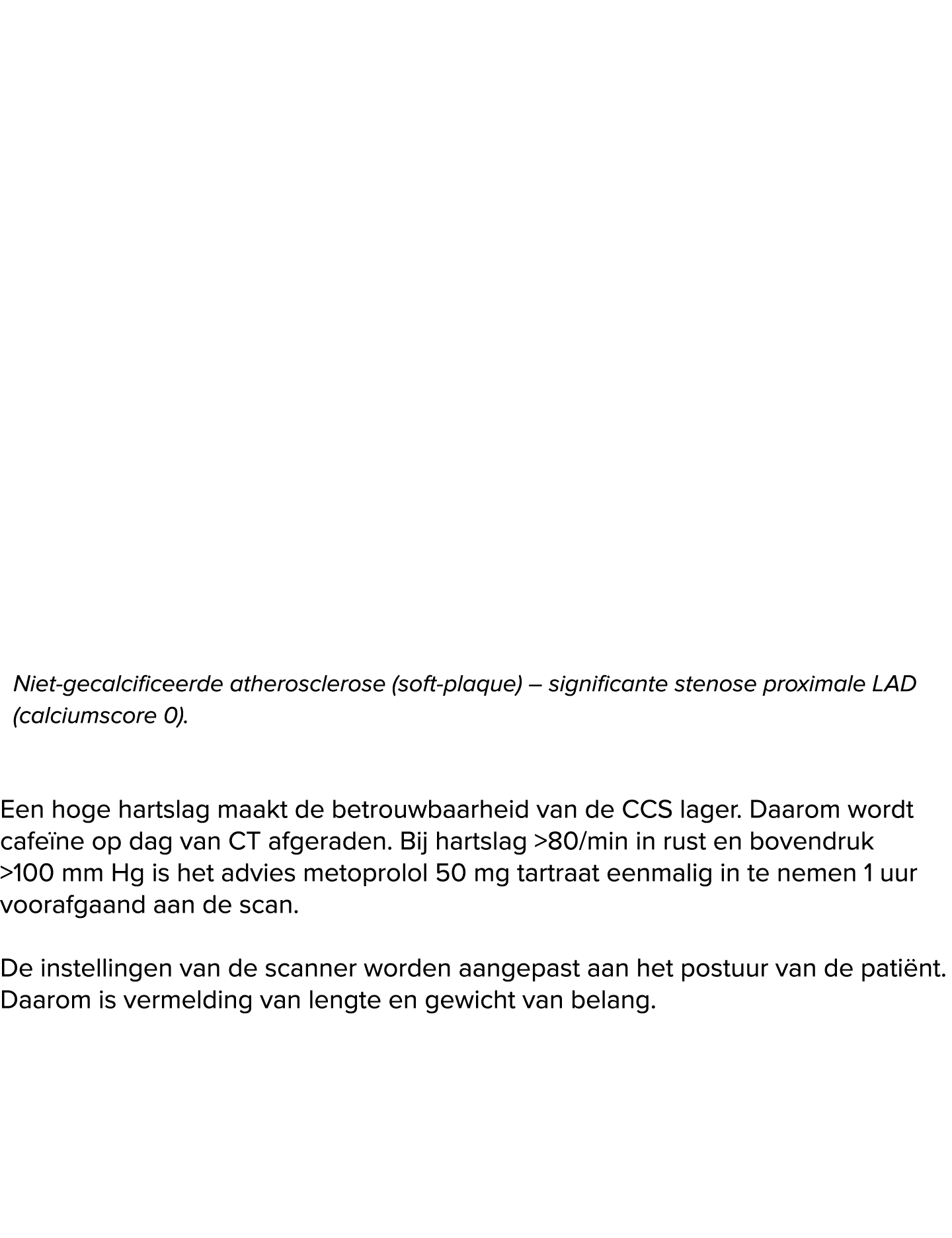  Niet gecalcificeerde atherosclerose (soft plaque) – significante stenose proximale LAD (calciumscore 0). Een hoge ha...